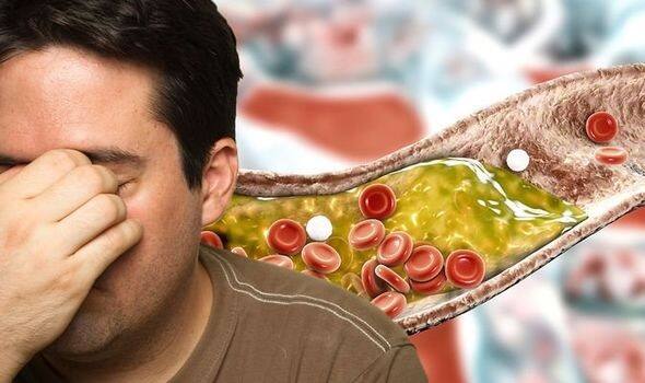 જો તમને પણ હાઈ કોલેસ્ટ્રોલની સમસ્યા છે, તો અમે અહીં કેટલાક એવા ફૂડ વિશે જણાવવા જઈ રહ્યા છીએ, જેનું સેવન કરવાથી તમે આ સમસ્યામાંથી ઝડપથી રાહત મેળવી શકો છો.