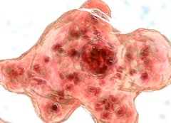 अमेरिका में दो साल के बच्चे का दिमाग खा गया अमीबा, हुई दर्दनाक मौत, डॉक्टरों ने भी कर दिए थे हाथ खड़े