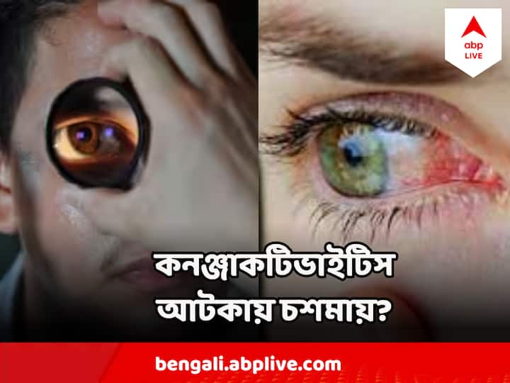 Conjunctivitis কে জয়বাংলা বলার একটি নির্দিষ্ট কারণ আছে। একেই বলে পিঙ্ক আই।