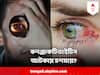 Conjunctivitis কে কেন বলে জয় বাংলা? চশমার আড়াল কি সংক্রমণ আটকাতে পারে ?