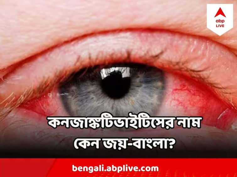 Conjunctivitis Cases Rising In India, why Is it called jay Bangla, Bacterial infection Viral Infection Conjunctivitis : কনজাঙ্কটিভাইটিস আর জয় বাংলা কি এক ? কোন ক্ষেত্রে কোন আইড্রপ কাজ করবে? জানালেন চক্ষুরোগ বিশেষজ্ঞ