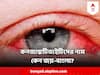Conjunctivitis : কনজাঙ্কটিভাইটিস আর জয় বাংলা কি এক ? কোন ক্ষেত্রে কোন আইড্রপ কাজ করবে? জানালেন চক্ষুরোগ বিশেষজ্ঞ