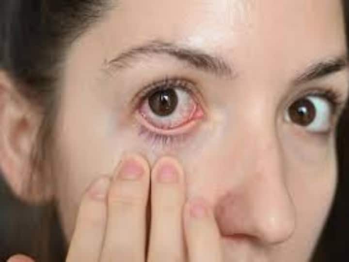 health tips delhi flood side effects for eyes causes of conjunctivitis know symptoms and treatment बारिश के मौसम में आंखों का रखें खास ध्यान, जानें दिल्ली में बाढ़ के बाद Pink Eyes क्यों कर रही है  परेशान