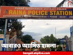 দুই সন্তানকে নিয়ে শৌচাগারে ঢুকেছিলেন, বেরোতেই অ্যাসিড হামলার শিকার, রায়নায় দগ্ধ গৃহবধূ