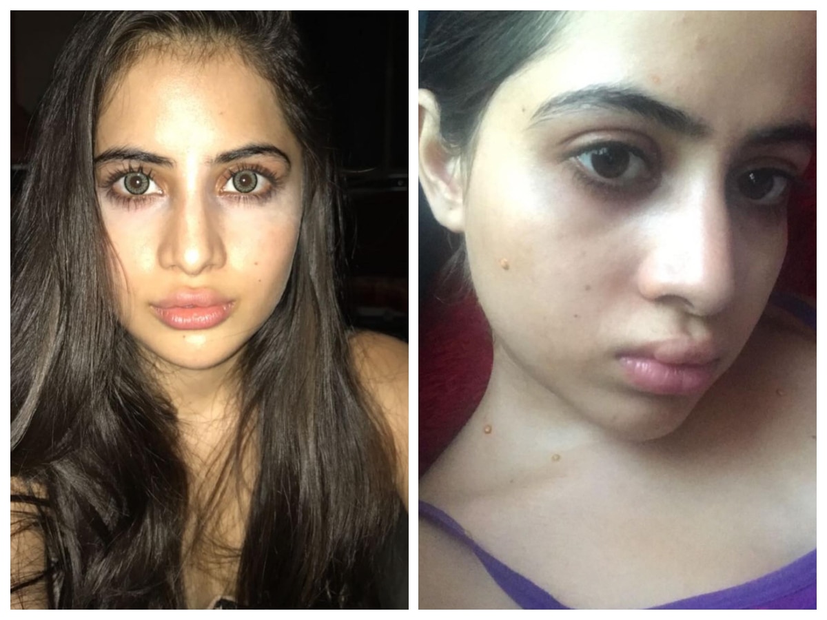 Uorfi Javed Recalls Her Journey Of Getting Lip And Undereye Fillers ...