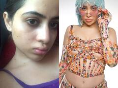 खूबसूरत लिप्स फिलर के पीछे उर्फी जावेद ने झेला है असहनीय दर्द! ऐसे-ऐसे पेन ले चुकी हैं बिग बॉस एक्स कंटेस्टेंट