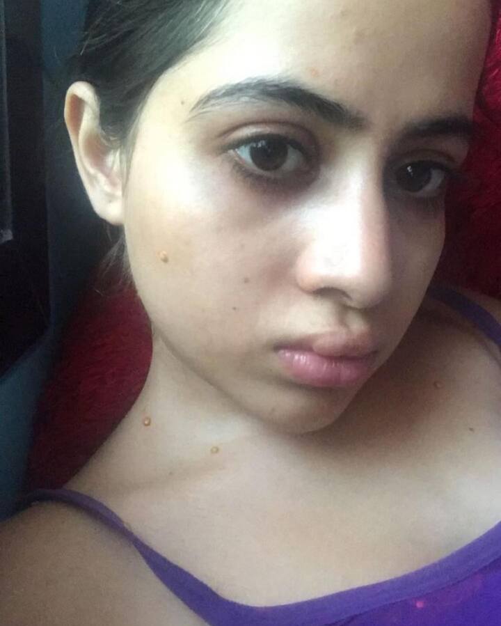 उर्फी जावेद ने अपने इंस्टाग्राम से अपनी कुछ पुरानी तस्वीरें शेयर की हैं. इन फोटोज में उर्फी काफी अलग दिख रही हैं. दरअसल, उर्फी की ये तस्वीरें उनके बोटॉक्स और फिलर की सर्जरी के बाद की हैं.