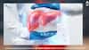 Health News: ਸ਼ਰਾਬ ਦਾ ਸੇਵਨ ਨਾ ਕਰਨ ਵਾਲੇ ਵੀ ਹੋ ਰਹੇ ਨੇ ਫੈਟੀ ਲੀਵਰ ਦਾ ਸ਼ਿਕਾਰ...ਜਾਣੋ ਅਜਿਹਾ ਕਿਉਂ