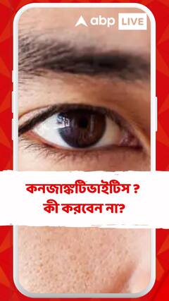 কনজাঙ্কটিভাইটিস ? এই কাজগুলি এড়িয়ে চলুন..