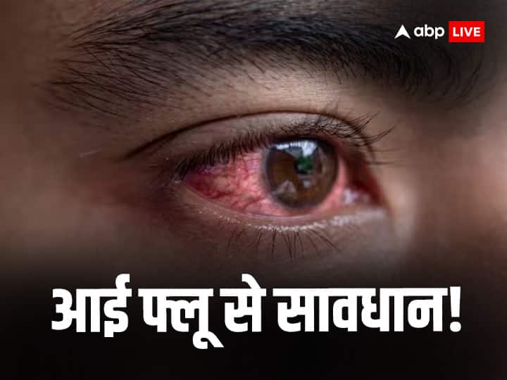 janjgiri champa News eye flu cases surged in know symptoms and its cure ann Eye Flu: जांजगीरी-चाम्पा के अस्पतालों में लग रही मरीजों की कतारें, ओपीडी में तीन गुना बढ़ी आई-फ्लू मरीजों की संख्या