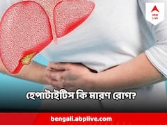 World Hepatitis Day 2023 : হেপাটাইটিস নিয়ে ভুল ধারণাগুলি ভেঙে ফেলুন, জেনে নিন কোনটা ঠিক কোনটা ভুল