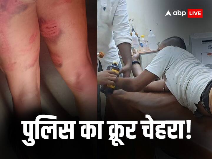 Bihar Police Beats Youth Who Complained for Bike Theft in Nagar Thana Jehanabad ann Bihar News: बिहार में बाइक चोरी की शिकायत पर उल्टा मिली सजा? जहानाबाद में युवक को पुलिस ने थाने बुलाकर कूटा