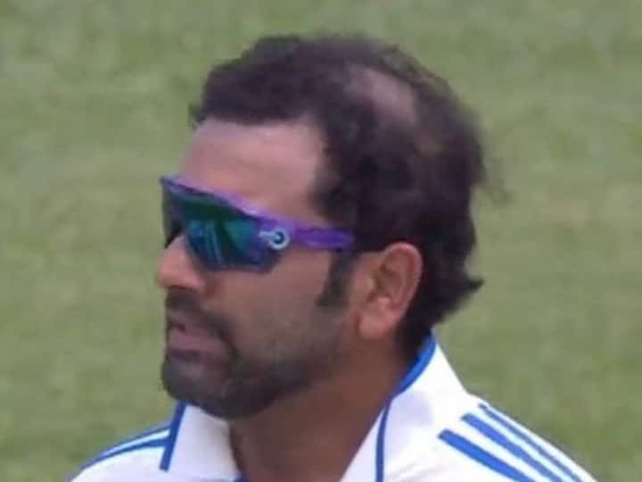 Rohit Sharma's hair fall Indian Cricket team captain loosing hairs rapidly photos on social Media getting viral Rohit Sharma: रोहित शर्मा के बाल कप्तानी की चिंता में उड़े, वायरल हो रही हैं ये तस्वीरें