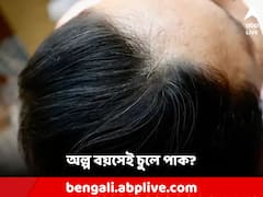 কম বয়সেই চুলে পাক ধরছে? কী করলে মিলতে পারে সমাধান?