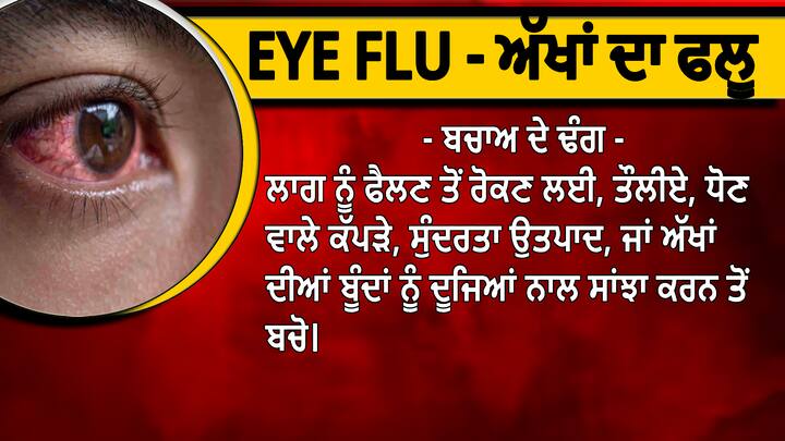 ਭਾਵੇਂ ਆਈ ਫਲੂ ਬਹੁਤ ਆਮ ਗੱਲ ਹੈ ਪਰ ਇਸ ਵਾਰ ਇਸ ਦੇ ਕਾਫੀ ਮਾਮਲੇ ਦੇਖਣ ਨੂੰ ਮਿਲ ਰਹੇ ਹਨ।