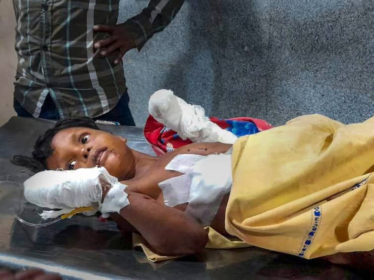 9-Year-Old Gets Injured After Touching Crude Bomb Explosion Blast In West Bengal's North 24 Parganas District Explosion News Minor Hurt Due To Crude Bomb Blast In West Bengal's North 24 Parganas, Admitted To Hospital