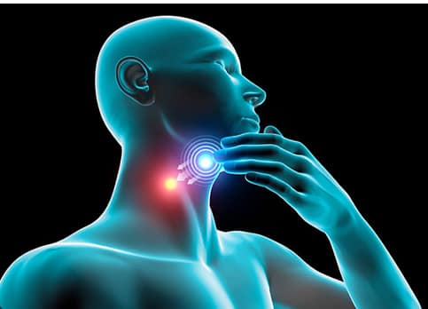 Head And Neck Cancers : ਕੈਂਸਰ ਕਈ ਤਰ੍ਹਾਂ ਦੇ ਹੁੰਦੇ ਹਨ। ਪਰ ਹਾਲ ਦੇ ਸਾਲਾਂ ਵਿੱਚ ਸਿਰ ਤੇ ਗਰਦਨ ਦਾ ਕੈਂਸਰ ਦੁਨੀਆ ਭਰ ਵਿੱਚ 6ਵੇਂ ਨੰਬਰ ਦੇ ਆਮ ਕੈਂਸਰਾਂ ਵਿੱਚੋਂ ਇੱਕ ਹੈ। ਸਭ ਤੋਂ ਹੈਰਾਨੀ ਦੀ ਗੱਲ ਇਹ ਹੈ ਕਿ 57.5 ਫੀਸਦੀ ਮਾਮਲੇ ਏਸ਼ੀਆ ਵਿੱਚ ਦਰਜ ਕੀਤੇ ਗਏ ਹਨ। ਉਸ ਵਿੱਚੋਂ ਖ਼ਾਸ ਕਰ ਭਾਰਤ ਅਜਿਹਾ ਦੇਸ਼ ਹੈ ਜਿਸ ਵਿੱਚ ਇਹ ਕੈਂਸਰ ਦੇ ਮਾਮਲੇ ਜ਼ਿਆਦਾ ਵੇਖਣ ਨੂੰ ਮਿਲ ਰਹੇ ਹਨ। ਇੰਟਰਨੈਸ਼ਨਲ ਏਜੰਸੀ ਫੌਰ ਰਿਸਰਚ ਆਨ ਕੈਂਸਰ (International Agency for Research on Cancer) ਦੇ ਮੁਤਾਬਕ ਸਾਲ 2040 ਤੱਕ ਇਸ ਦੀ ਗਿਣਤੀ ਵਿੱਚ 50-60 ਫੀਸਦੀ ਦਾ ਵਾਧਾ ਹੋਣ ਦੀ ਉਮੀਦ ਹੈ।