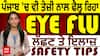 Eye Flu Remedies : ਜੇ ਸਮੇਂ 'ਤੇ ਗੌਰ ਨਾ ਕੀਤੀ ਤਾਂ EYE FLU ਹੋ ਸਕਦੈ ਖ਼ਤਰਨਾਕ, ਜਾਣੋ ਲੱਛਣ ਤੇ ਇਲਾਜ਼