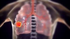 World Lung Cancer Day:ক্ষতি করছে তামাক? কী ভাবে বুঝবেন? World Lung Cancer Day-তে নজরে মারণ-নেশার অভিঘাত