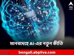 পক্ষাঘাতগ্রস্ত ব্যক্তির হাতে-পায়ে সাড় ফিরিয়ে দিল AI, ফের চমক কৃত্রিম বুদ্ধিমত্তার