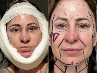 बुढ़ापे में 'खूबसूरत' बनने का चढ़ा खुमार, 'प्लास्टिक सर्जरी' कराने के लिए महिला ने बेच डाला अपना घर