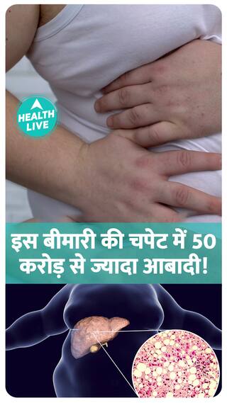 Fatty liver disease in kids alarming, says AIIMS