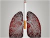 World Lung Cancer Day: నిరంతరం దగ్గు వస్తుందా? విస్మరించొద్దు, ఆ క్యాన్సర్ ప్రమాదం పొంచి ఉంది