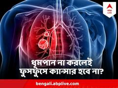ফুসফুসে ক্যান্সার ধরা পড়ে অত্যন্ত দেরিতে!অনেক সময়ই থাকে না লক্ষণ, কীভাবে এড়াবেন মৃত্যু?