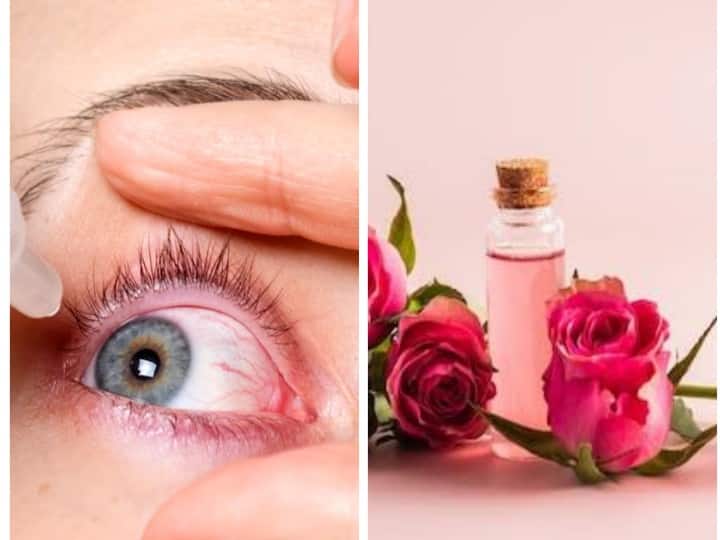 Pink Eye में गुलाब जल का इस्तेमाल आंखों में करना चाहिए या नहीं? यहां जानें जवाब