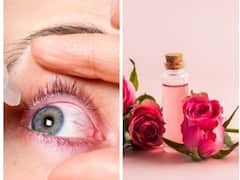 Pink Eye में गुलाब जल का इस्तेमाल आंखों में करना चाहिए या नहीं? यहां जानें जवाब