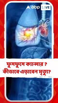 ফুসফুসে ক্যান্সার ধরা পড়ে অত্যন্ত দেরিতে!অনেক সময়ই থাকে না লক্ষণ, কীভাবে এড়াবেন মৃত্যু?
