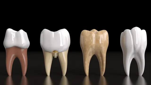 Dirty teeth can cause heart diseases, revealed in the research. Teeth- ਗੰਦੇ ਦੰਦ ਬਣ ਸਕਦੇ ਨੇ ਦਿਲ ਦੀ ਬਿਮਾਰੀਆਂ ਦੇ ਕਾਰਨ, ਰਿਸਰਚ 'ਚ ਹੋਇਆ ਖੁਲਾਸਾ, ਅੱਜ ਤੋਂ ਹੀ ਆਹ ਸਾਵਧਾਨੀਆਂ ਵਰਤੋ