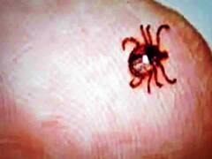 हिमाचल प्रद्रेश में जानलेवा स्क्रब टायफस का 'खतरा', अब तक 242 मामले हुए रिपोर्ट