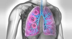 World Lung Cancer Day: ફેફસાને જીવનભર હેલ્ધી રાખવા માટે આ હર્બ્સને ડાયટમાં કરો સામેલ