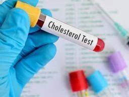 તમારે દર વર્ષે કોલેસ્ટ્રોલની તપાસ કરાવવી જોઈએ. જો આપને  ડાયાબિટીસ, હાર્ટ કે કિડનીને લગતી કોઈ સમસ્યા હોય તો ડોક્ટરની સલાહ પર પણ જલ્દી ટેસ્ટ કરાવતા રહો.