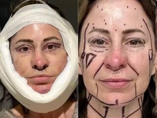 OMG : ਬੁਢਾਪੇ 'ਚ 'ਖੂਬਸੂਰਤ' ਬਣਨ ਦਾ ਚੜ੍ਹਿਆ ਖੁਮਾਰ, ਔਰਤ ਨੇ ਪਲਾਸਟਿਕ ਸਰਜਰੀ ਕਰਵਾਉਣ ਲਈ ਵੇਚ ਦਿੱਤਾ ਘਰ