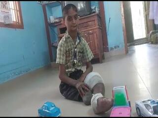 உடல் அடிக்கடி சூடாகும் ஆனால் வியர்க்காது... வலி உணர்வு இருக்காது - விசித்திர நோயால் 14 வயது சிறுவன் பாதிப்பு