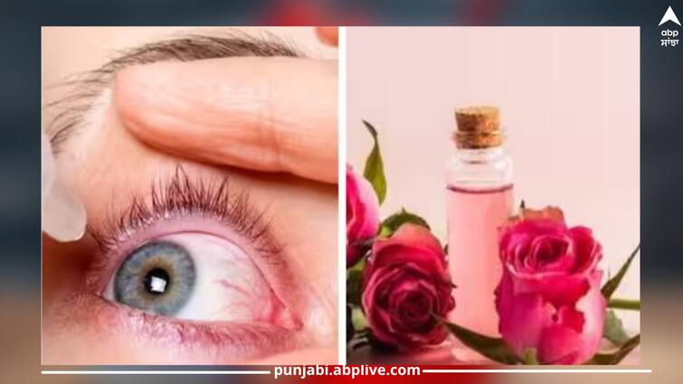 rose water should be used in pink eyes or not health news Pink Eye ਵਿੱਚ ਗੁਲਾਬ ਜਲ ਅੱਖਾਂ ਵਿੱਚ ਪਾਉਣਾ ਚਾਹੀਦਾ ਹੈ ਜਾਂ ਨਹੀਂ? ਇੱਥੇ  ਜਾਣੋ ਜਵਾਬ