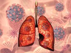 मामूली दिखने वाले ये 7 लक्षण हो सकते हैं लंग्स कैंसर के संकेत