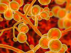 14 साल पहले आई थी दुनिया में ये बीमारी, अब खतरनाक तरीके से फैलने लगी है