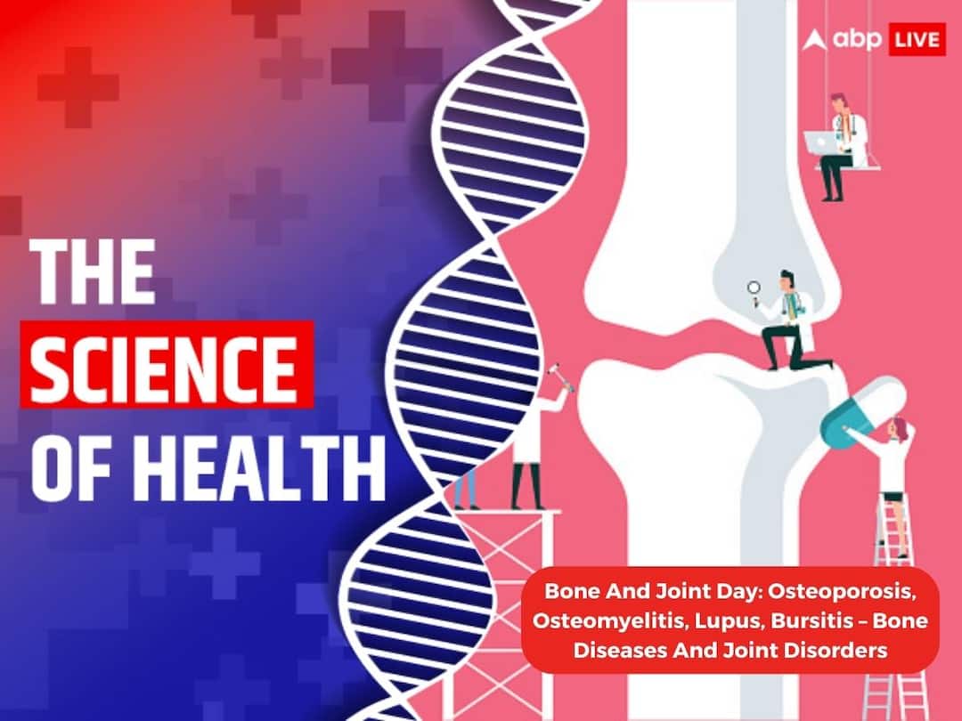 Bone And Joint Day 2023 Osteoporosis Osteoarthritis Osteopenia