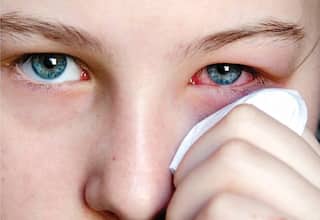 Eye Flu:'આઈ ફ્લૂ' એક જ પ્રકારનો નથી, નિષ્ણાતો પાસેથી જાણો કયો છે સૌથી ખતરનાક