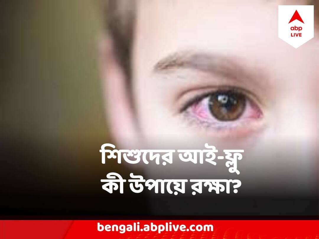 Eye Flu Conjunctivitis Spreading Rapidly In Children, know how to keep children safe Eye Flu Conjunctivitis : শিশুদের মধ্যে দ্রুত ছড়াচ্ছে কনজাঙ্কটিভাইটিস, কীভাবে বাঁচাবেন? জেনে নিন উপায়