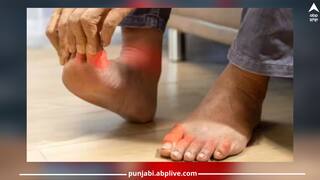 Health Tips: ਸਰੀਰ ਦੇ ਕਿਸੇ ਵੀ ਹਿੱਸੇ 'ਚ ਸੋਜ ਨੂੰ ਨਜ਼ਰਅੰਦਾਜ਼ ਨਾ ਕਰੋ, ਖਾਓ ਇਹ 5 ਅਸਰਦਾਰ ਚੀਜ਼ਾਂ, ਜਲਦੀ ਮਿਲੇਗੀ ਰਾਹਤ