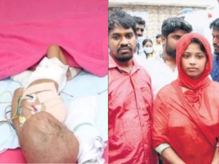 hand removed ramanathapuram child died in chennai egmore Government Children Hospital காலையிலேயே சோகம்.. ராஜீவ்காந்தி மருத்துவமனையில் கை அகற்றப்பட்ட ஒன்றரை வயது குழந்தை மரணம்..