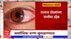 Eye Infection : राज्यात डोळ्यांच्या साथीचा उद्रेक, बुलढाण्यात आढळले सर्वाधिक रुग्ण