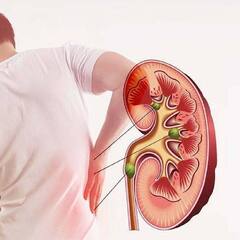 Kidney Disease: ਕਿਡਨੀ ਡੈਮੇਜ਼ ਦੇ ਲੱਛਣਾਂ ਨੂੰ ਪਛਾਣਨਾ ਹੈ ਜ਼ਰੂਰੀ, ਨਹੀਂ ਤਾਂ...