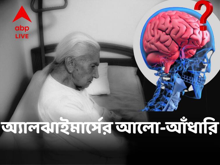 Alzheimers Disease And Its Reported Prevalence In Women Than Men Along With Possible Prevention Suggestion ABP Live Exclusive Alzheimer's Disease:অ্যালঝাইমার্সের গোলক-ধাঁধায় 'পথ হারানোর' আশঙ্কা বেশি মহিলাদের? কী ভাবে মোকাবিলা? কী বললেন বিশেষজ্ঞরা