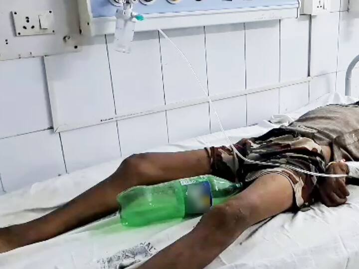 Bihar Jamui Sadar Hospital Doctor Used Cold Drink Bottle Instead of Urinal Bag ann जुगाड़ का नाम बिहार! ये कैसी स्वास्थ्य व्यवस्था? यूरिनल बैग खत्म हुआ तो मरीज को लगा दी कोल्ड ड्रिंक की बोतल