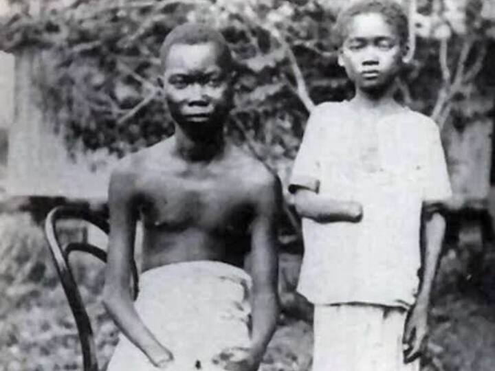 किंग लियोपोल्ड II ने साल 1885 से लेकर 1908 तक कांगों में जमकर अत्याचार किए. इस दौरान उसने काले लोगों से बंधुआ मजदूरी करवाई.